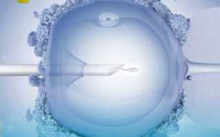 Мифы об ЭКО