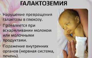 Галактоземия у новорожденных — симптомы и лечение