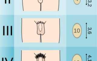 Половое развитие мальчиков — варианты нормы и отклонения