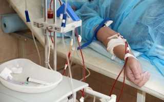 Зачем делать плазмаферез при беременности, и можно ли обойтись без него?