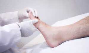 Полезные советы о том, как не допустить опрелости между пальцами ног