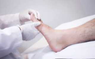 Полезные советы о том, как не допустить опрелости между пальцами ног