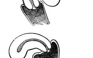 Летерофлексия матки: причины и методы устранения