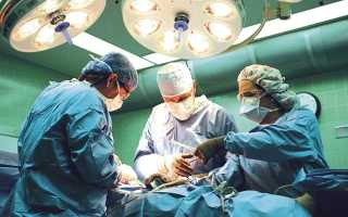 Болезнь Гиршпрунга у взрослых: симптомы и лечение при синдроме