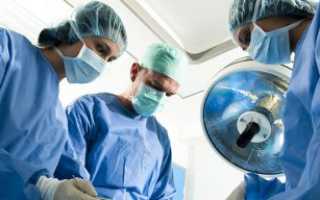 Лучевая терапия после удаления матки с придатками: способы и этапы выполнения