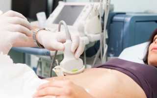 УЗИ лимфоузлов — показания к назначению исследования, особенности проведения и расшифровка результатов