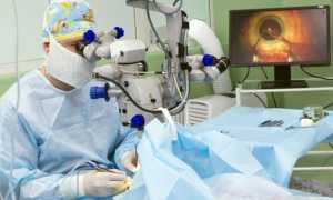 Дедистрофическая терапия в офтальмологии — уколы, лечение лазером и фзиотерапия