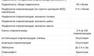 Спермограмма: как сдавать и расшифровка результатов