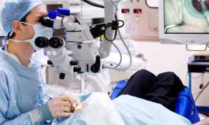 Замена хрусталика глаза: операция и послеоперационный период