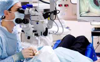 Замена хрусталика глаза: операция и послеоперационный период