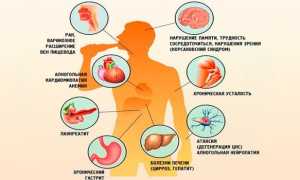 Причины и профилактика подросткового алкоголизма
