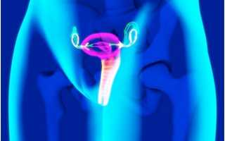 Влияние латероверсии матки на детородную функцию женщины