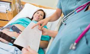 КТГ при беременности