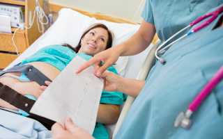 КТГ при беременности