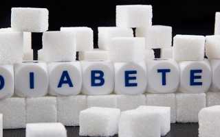 Морбидное ожирение — степени и причины заболевания, методы лечения и диета