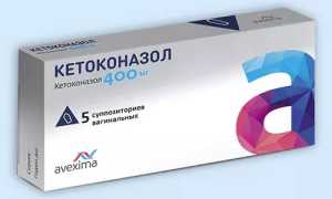 В каких случаях помогает Кетоконазол от грибка?