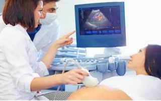 Все об амниотическом индексе при беременности: нормы и отклонения