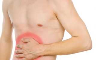 Язва желудка — симптомы