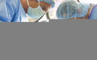 Фибромиома молочной железы