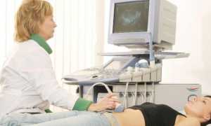 Может ли киста яичника рассосаться сама