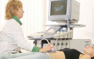 Может ли киста яичника рассосаться сама