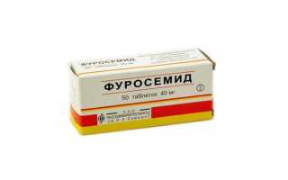 Отеки при диабете — причины и симптомы, диагностика, методы лечения и профилактика