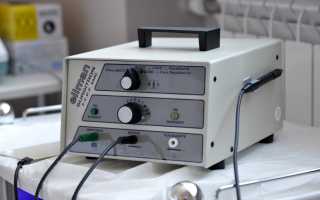 Радиоволновое лечение дисплазии шейки матки: как избавиться от предракового состояния?