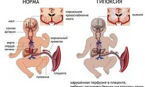 Чем можно лечить насморк при беременности во втором триместре