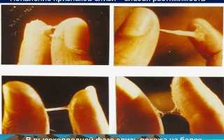 Почему появляются выделения «яичный белок» до или после овуляции?