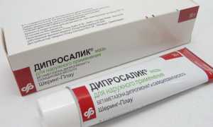 Быстрое избавление от псориаза на голове при помощи лосьона