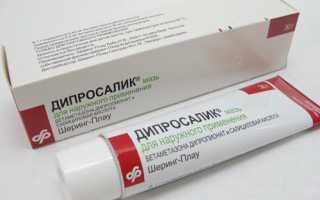 Быстрое избавление от псориаза на голове при помощи лосьона