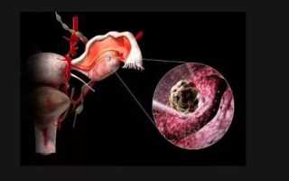 За сколько дней до овуляции можно забеременеть: как рассчитать правильные дни?