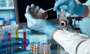 Мазок из горла — как сдать анализ на инфекции