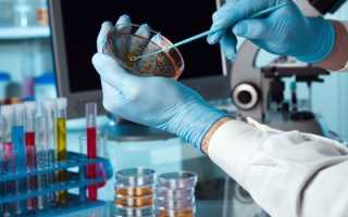 Мазок из горла — как сдать анализ на инфекции