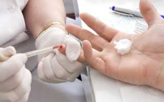 Анализ крови на сахар