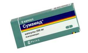 Ушивание прободной язвы желудка — показания, порядок проведения операции и осложнения