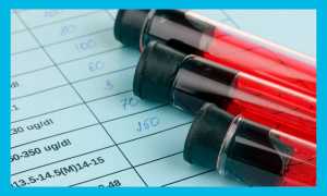 Циклодинон: как принимать при планировании беременности