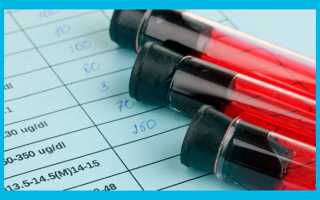 Циклодинон: как принимать при планировании беременности