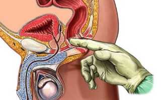 Как лечить предстательную железу у мужчин