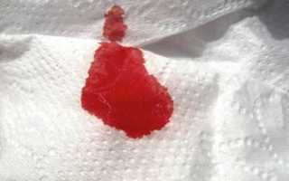 Патологические и нормальные выделения после удаления матки