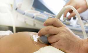 УЗИ во время беременности