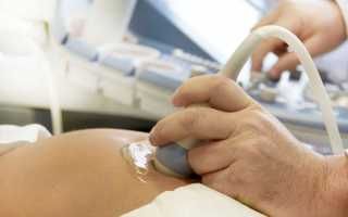 УЗИ во время беременности