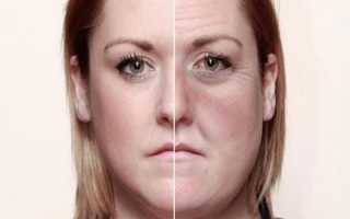 Последняя стадия алкоголизма у женщин и мужчин