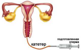 Инсеминация