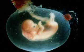 Как отходят воды у беременных перед родами