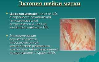 Почему развивается эрозия шейки матки у девственниц?