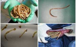 Паразиты в организме человека — симптомы и лечение