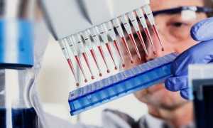 Как сдавать анализ на гормоны щитовидной железы — правила подготовки