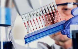 Как сдавать анализ на гормоны щитовидной железы — правила подготовки