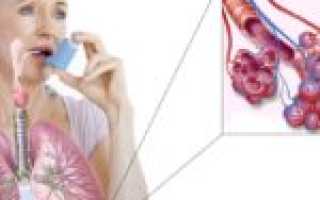 Лечение и профилактика молочницы на половых органах у мужчин